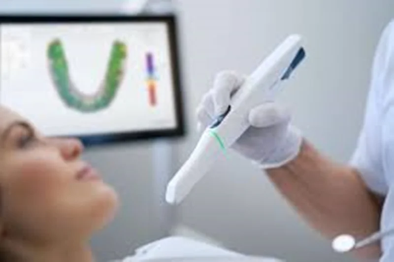 اسکنر سهبعدی دندانپزشکی (Intraoral Scanner)